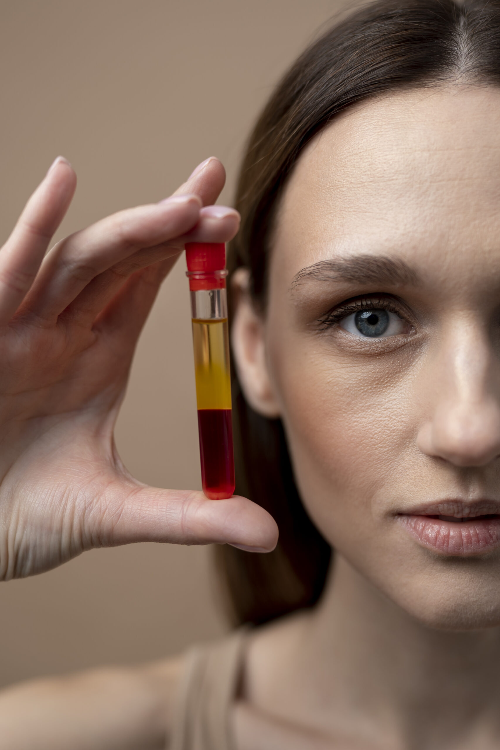 young-woman-holding-prp-vial